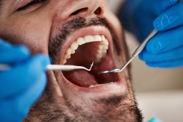 Best Emergency Treatment for Dental Infections or Abscesses in Andrews Af, MD